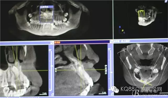 640.webp (2).jpg 640.webp (2).jpg