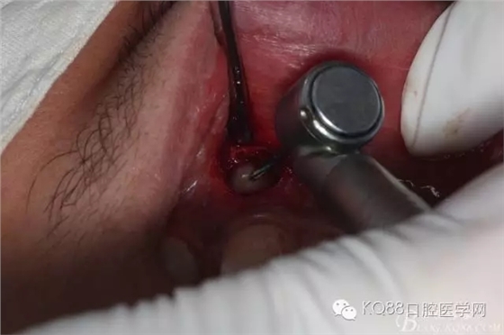 640.webp (6).jpg 640.webp (6).jpg