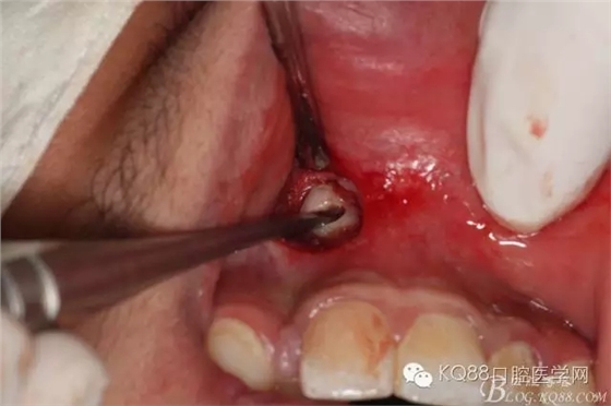 640.webp (9).jpg 640.webp (9).jpg