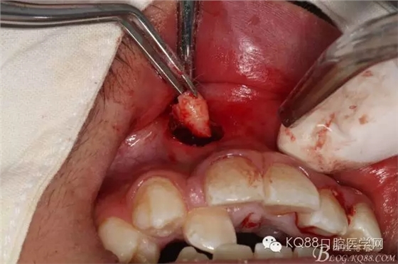 640.webp (11).jpg 640.webp (11).jpg