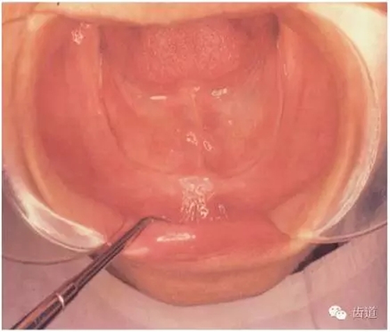 640.webp (11).jpg 640.webp (11).jpg