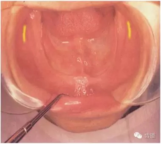 640.webp (13).jpg 640.webp (13).jpg