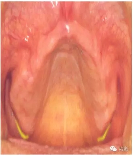 640.webp (30).jpg 640.webp (30).jpg