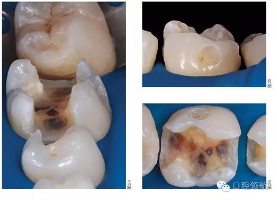 640.webp.jpg 640.webp.jpg