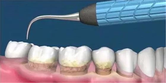 640.webp.jpg 640.webp.jpg