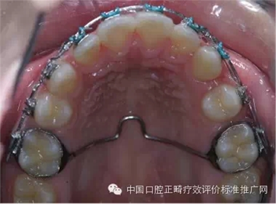 0.webp.jpg 0.webp.jpg