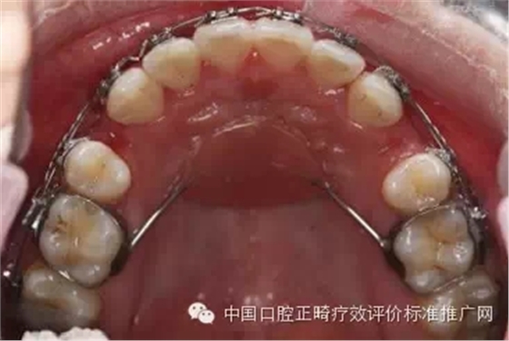 0.webp (1).jpg 0.webp (1).jpg