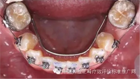 0.webp (2).jpg 0.webp (2).jpg