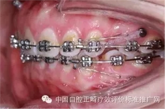 0.webp (3).jpg 0.webp (3).jpg