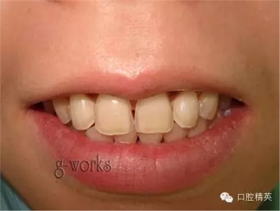 640.webp.jpg 640.webp.jpg