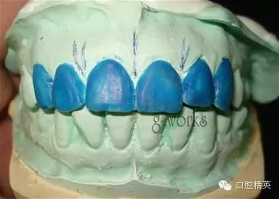 640.webp (2).jpg 640.webp (2).jpg