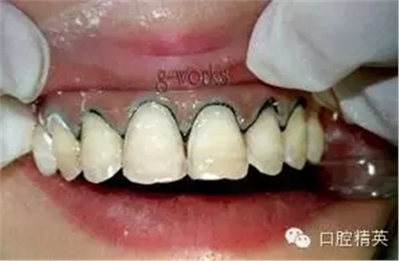 640.webp (9).jpg 640.webp (9).jpg