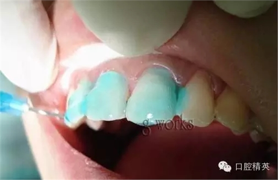 640.webp (23).jpg 640.webp (23).jpg