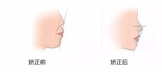 640.webp (5).jpg 640.webp (5).jpg