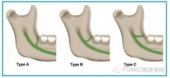 640.webp (2).jpg 640.webp (2).jpg