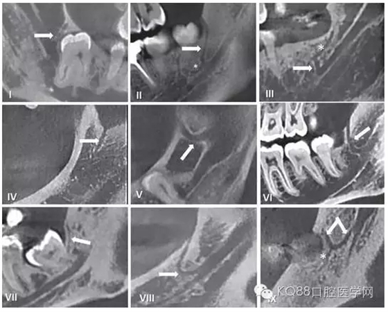 640.webp (4).jpg 640.webp (4).jpg