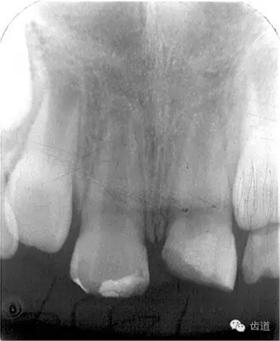 640.webp (3).jpg 640.webp (3).jpg