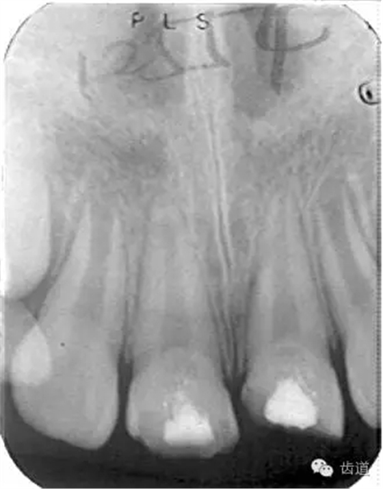 640.webp (4).jpg 640.webp (4).jpg