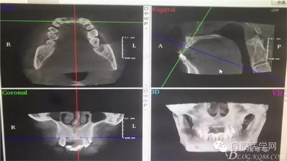 640.webp.jpg 640.webp.jpg