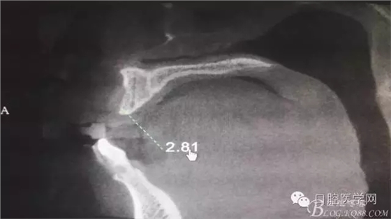 640.webp (1).jpg 640.webp (1).jpg