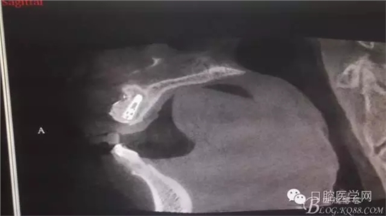 640.webp (4).jpg 640.webp (4).jpg