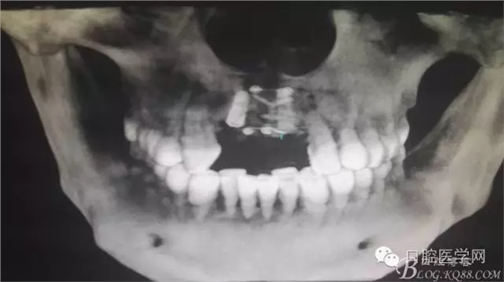 640.webp (6).jpg 640.webp (6).jpg