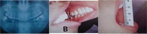 640.webp (9).jpg 640.webp (9).jpg