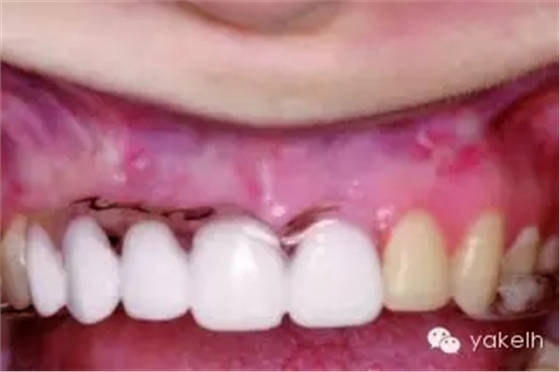 640.webp.jpg 640.webp.jpg