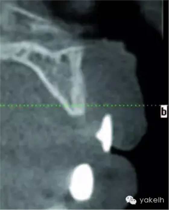 640.webp (1).jpg 640.webp (1).jpg