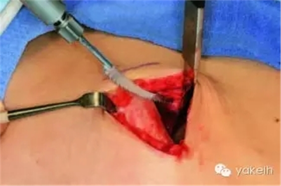 640.webp (4).jpg 640.webp (4).jpg