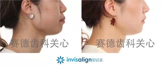 640.webp (3).jpg 640.webp (3).jpg