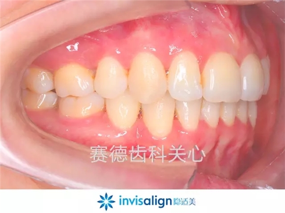 640.webp (4).jpg 640.webp (4).jpg