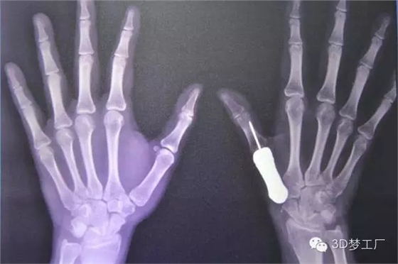 640.webp.jpg 640.webp.jpg