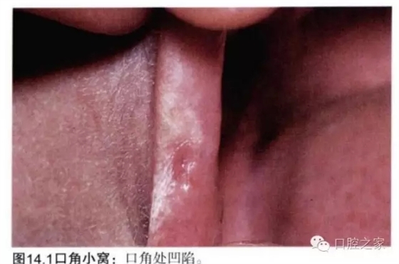 640.webp.jpg 640.webp.jpg