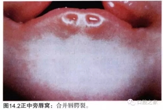 640.webp (1).jpg 640.webp (1).jpg