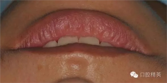 640.webp (18).jpg 640.webp (18).jpg