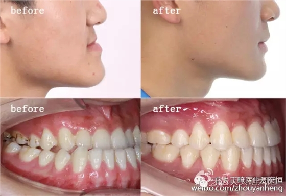 640.webp (4).jpg 640.webp (4).jpg