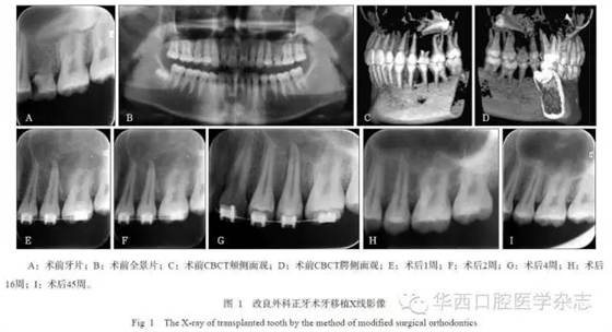 640.webp (2).jpg 640.webp (2).jpg