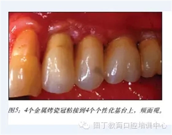 640.webp (4).jpg 640.webp (4).jpg