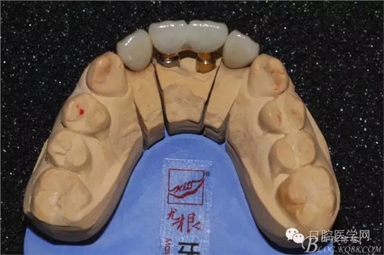 640.webp (10).jpg 640.webp (10).jpg