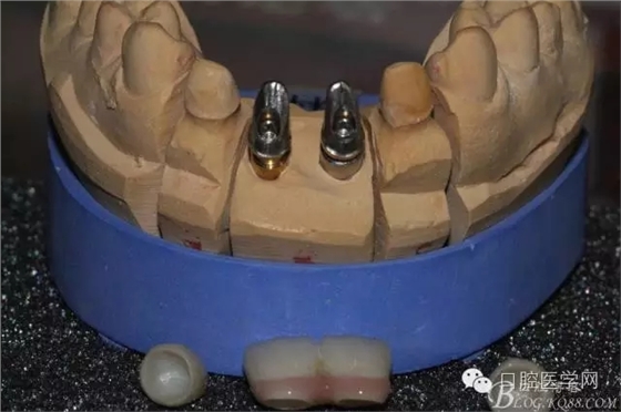 640.webp (13).jpg 640.webp (13).jpg