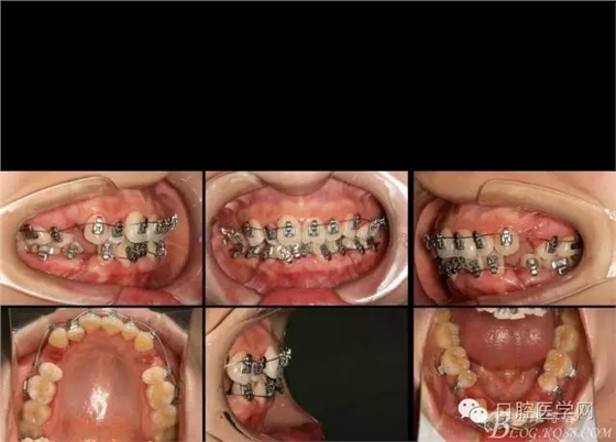 640.webp (2).jpg 640.webp (2).jpg