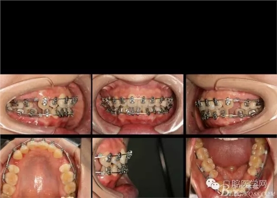 640.webp (3).jpg 640.webp (3).jpg