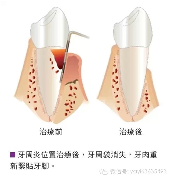 0.webp (2).jpg 0.webp (2).jpg