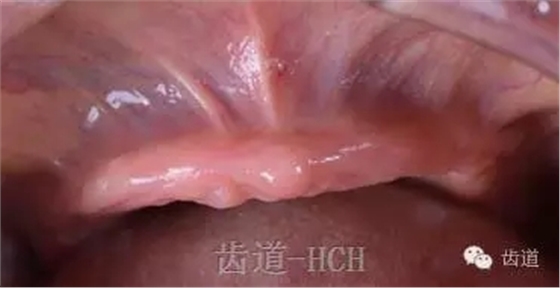 640.webp (3).jpg 640.webp (3).jpg