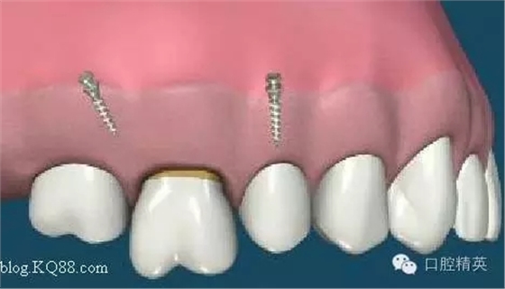 640.webp (1).jpg 640.webp (1).jpg