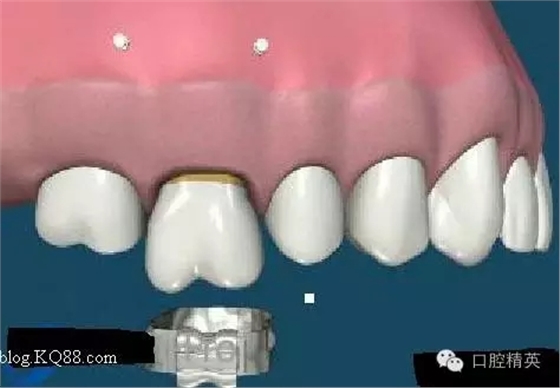 640.webp (3).jpg 640.webp (3).jpg