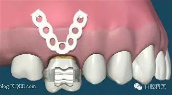 640.webp (4).jpg 640.webp (4).jpg