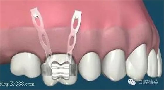 640.webp (5).jpg 640.webp (5).jpg