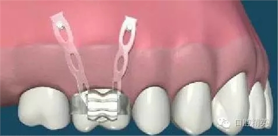 640.webp (6).jpg 640.webp (6).jpg